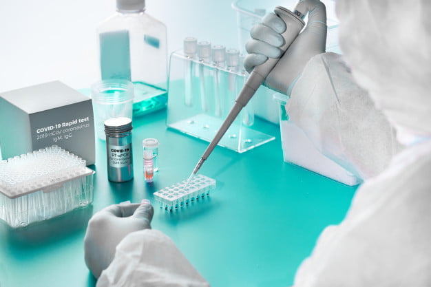deteccion-novedosa-coronavirus-kit-pcr-deteccion-nuevos-coronavirus-sars-cov-2-kit-rapido-detectar-anticuerpos-virus-sangre-pacientes-recuperados-epidemiologo-trabaja-laboratorio-pruebas_87646-5569