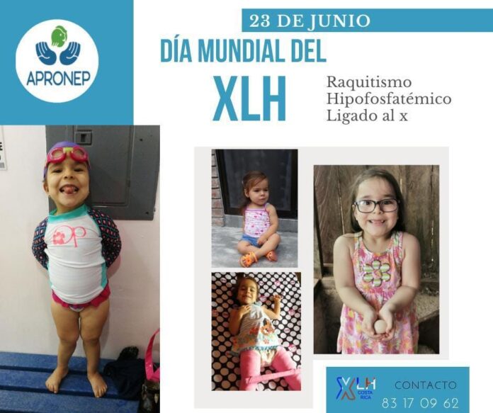 SOFI