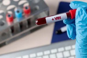 Tubo de muestra sanguínea marcado con VIH