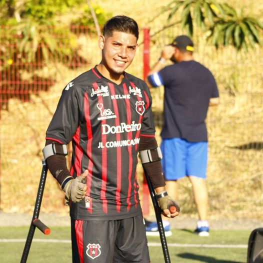 amputado 1