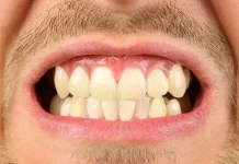 Salud dental enfrenta desigualdad económica