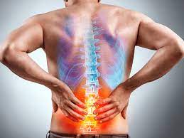 lumbargia